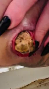 Look at that prolapse! - UltraHD 4K [Taylor Nicole] Solo, Big Pile