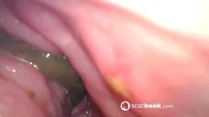 Endoscope In My Ass [FullHD 1080p] Dildo, Anal